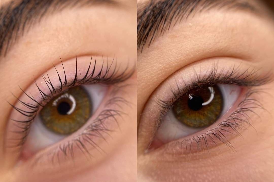 Efekty zabiegów - Mon Ami