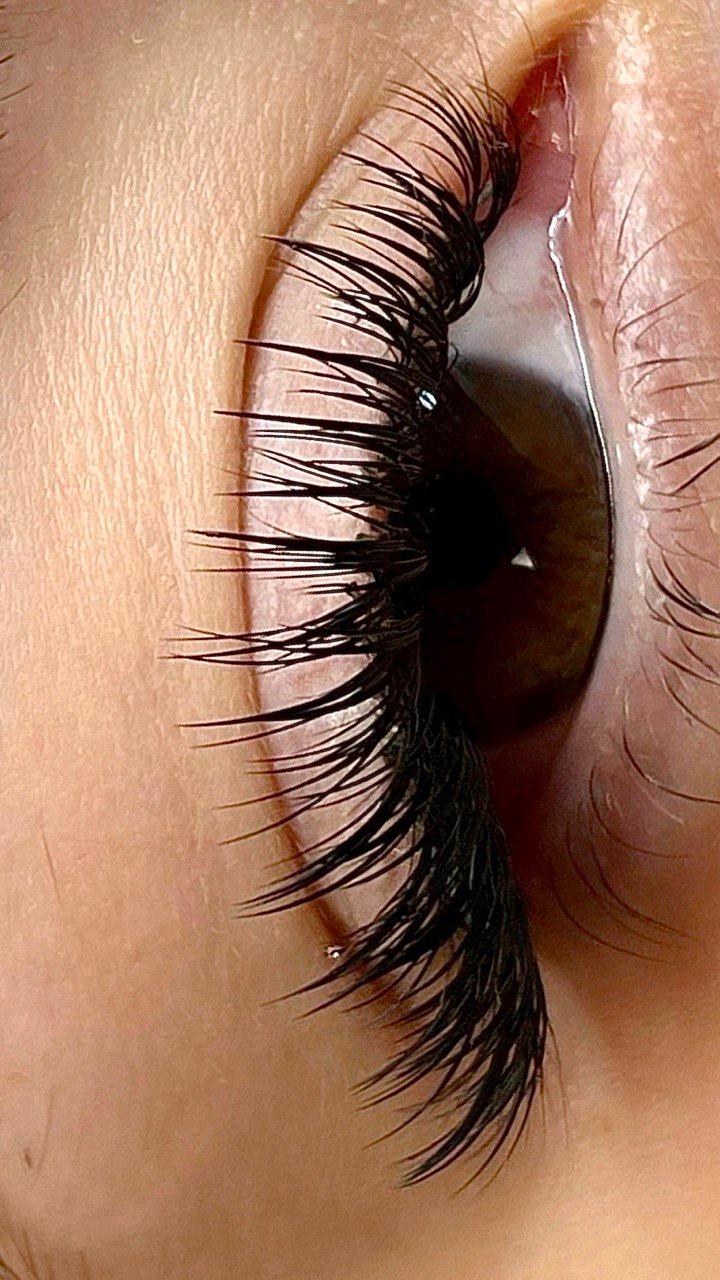 Efekty zabiegów - Mon Ami